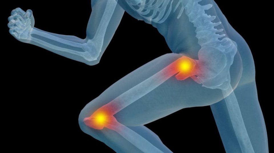 Especialistas Orientam Como Evitar Dores No Joelho E No Quadril
