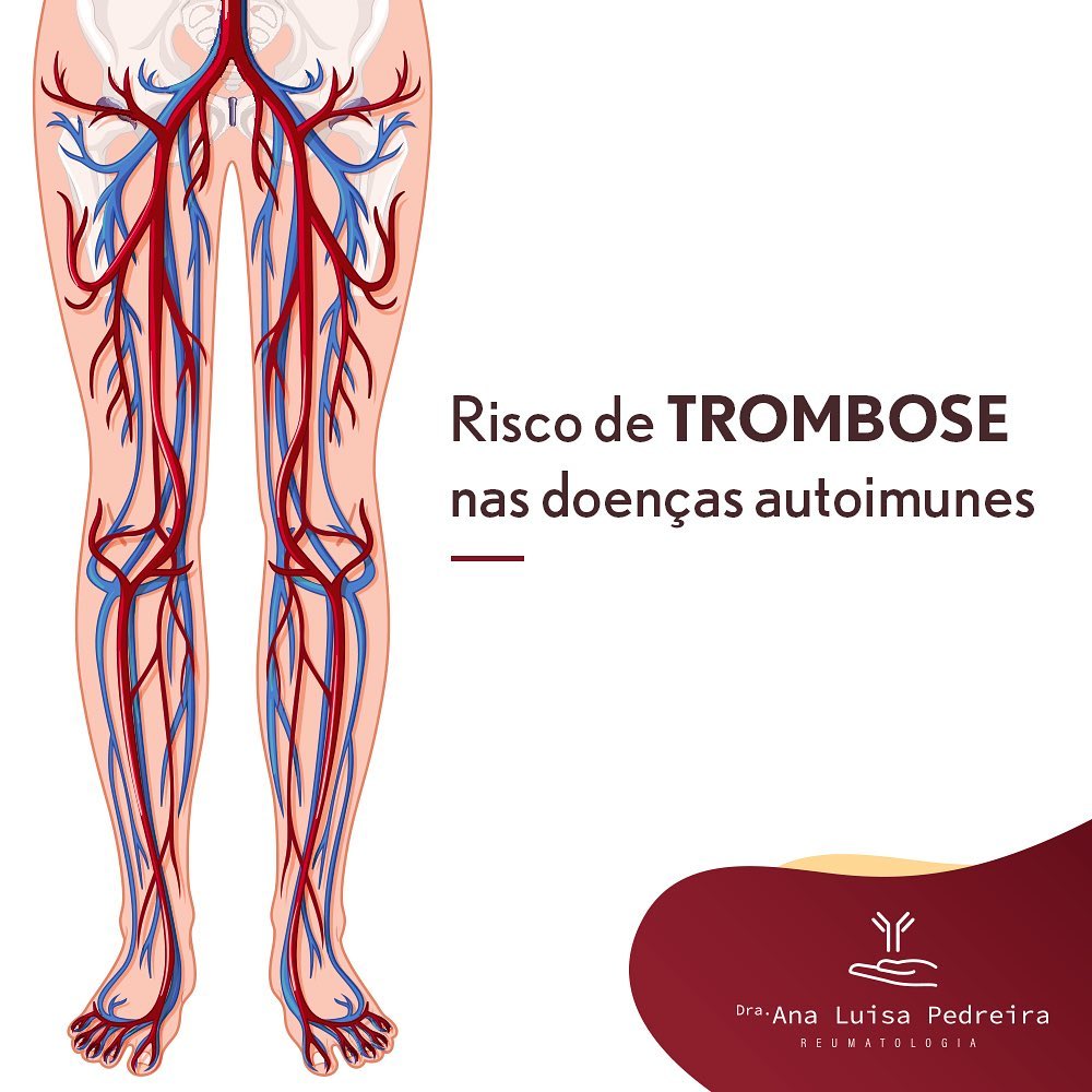 Risco de trombose nas doenças autoimunes Artrite Reumatoide