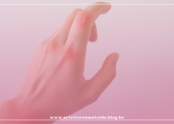 Entendendo o tratamento médico da Artrite Reumatoide