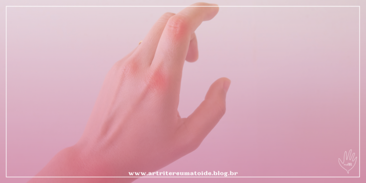 Entendendo o tratamento médico da Artrite Reumatoide