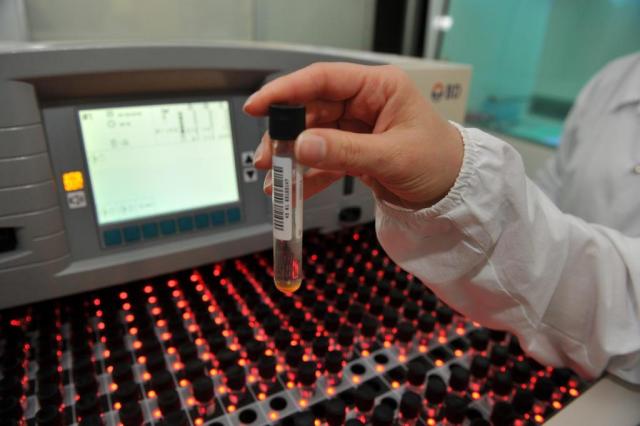 Brasil está sem teste que detecta tuberculose latente