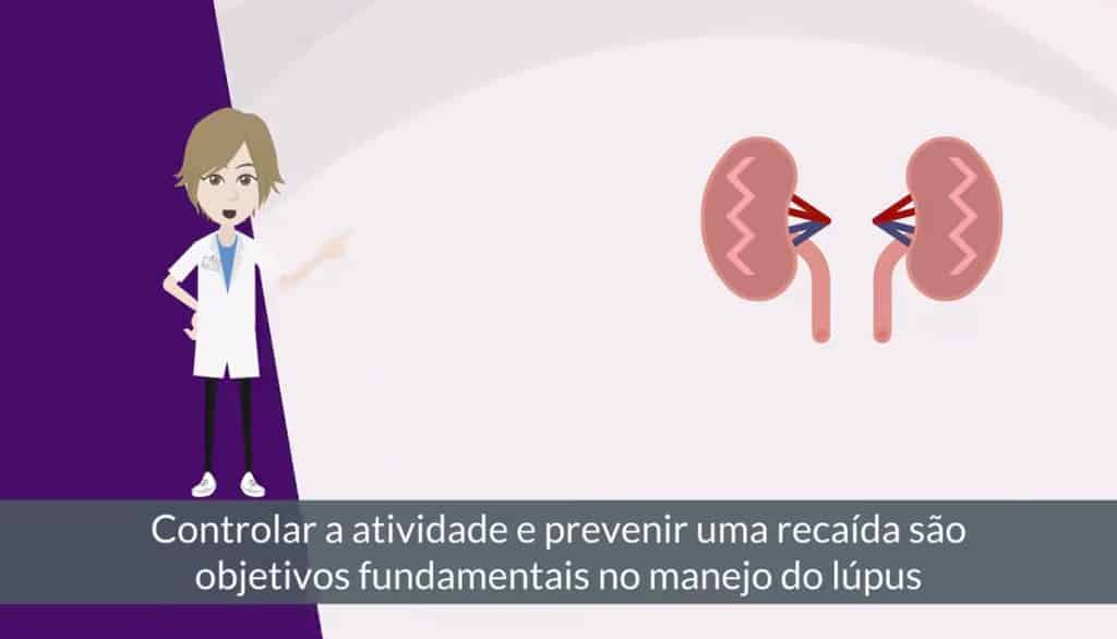 Como controlar e prevenir a atividade ou recaídas do lupus?