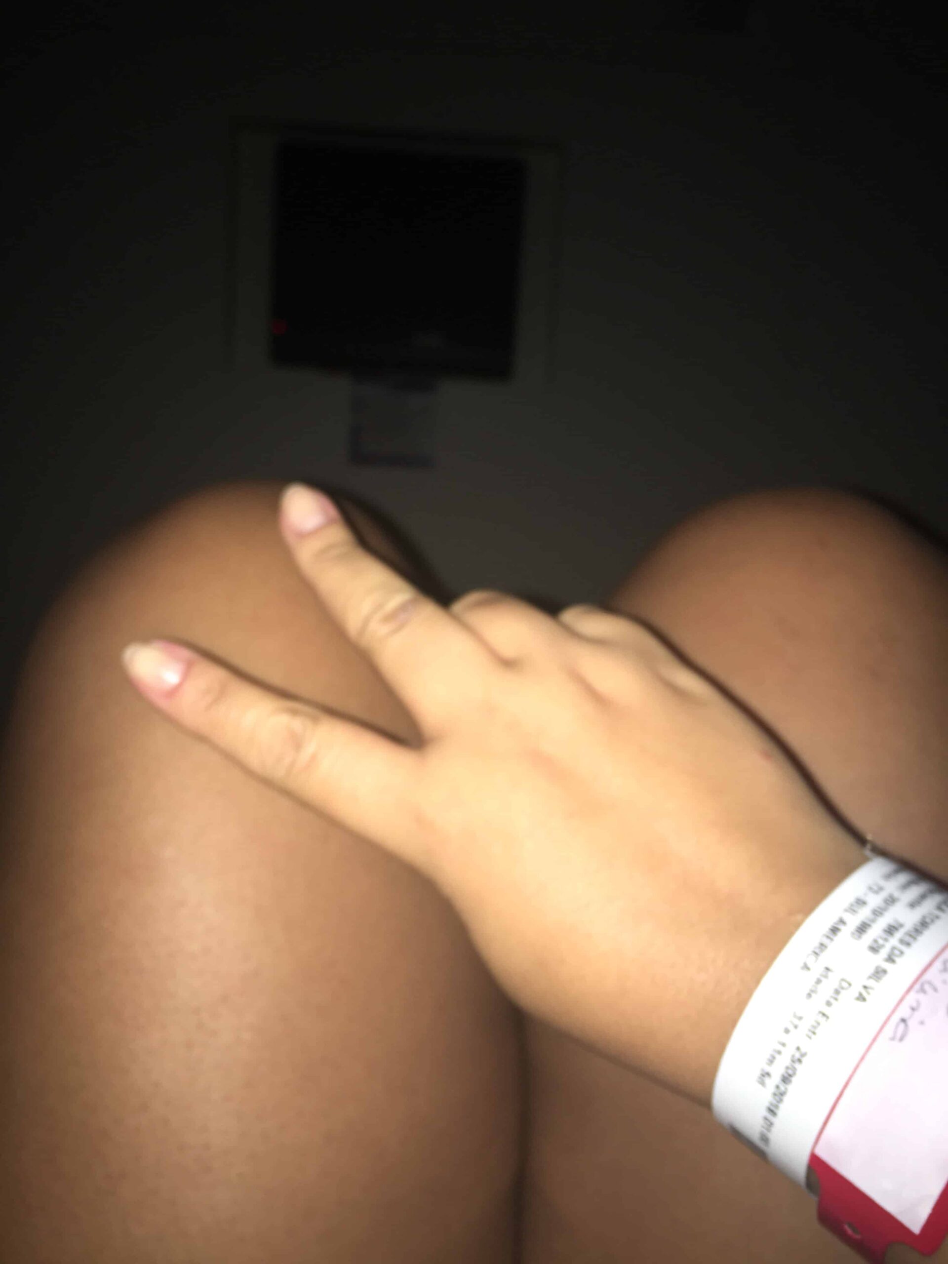 Início da jornada bariatricAR