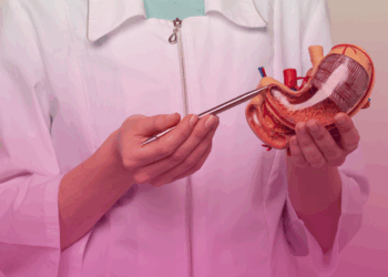 Cinco fatos que você precisa saber sobre a cirurgia bariátrica no SUS