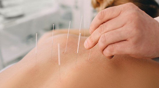Acupuntura no manejo da dor crônica