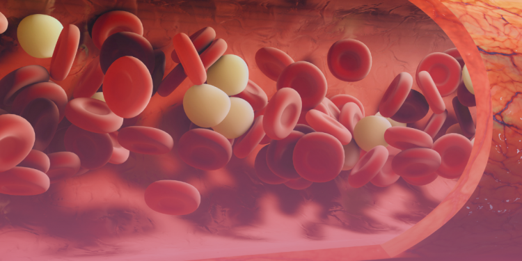 Síndrome do Anticorpo Antifosfolipídeo (SAF)