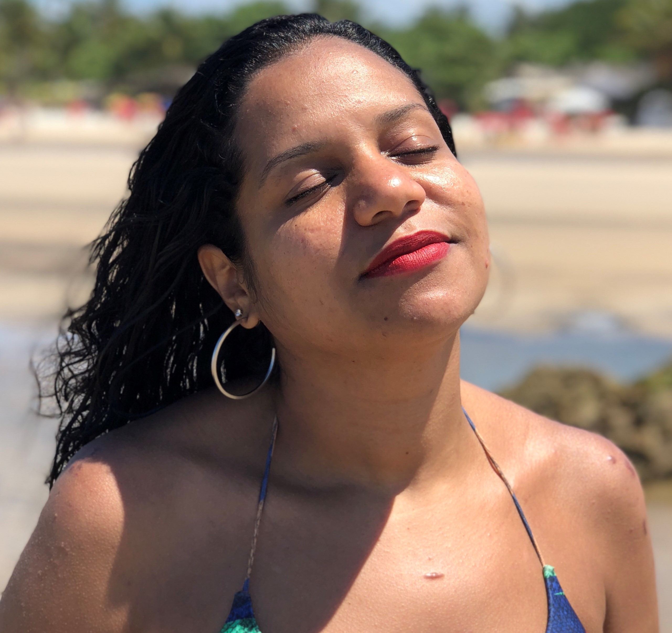 Tudo que sou, agradeço ao lúpus e as lições que ele me deu