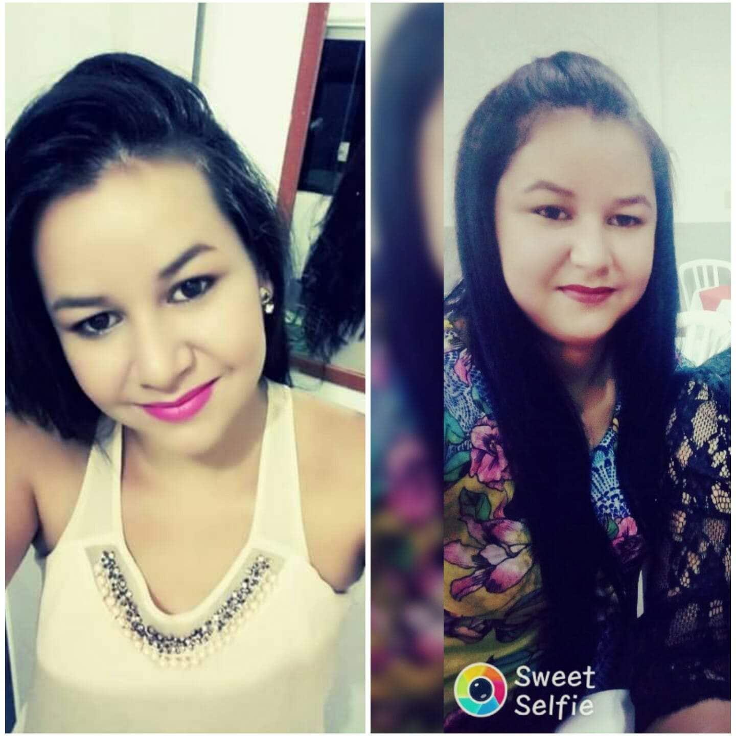 Tenho Lúpus e suas complicações, mas acima de tudo, tenho fé