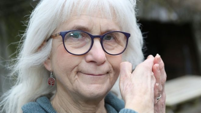 Doença do gene feliz faz mulher com artrite não sentir dor