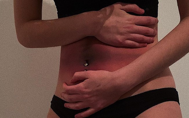 Jovem usa maquiagem para “pintar a dor” da síndrome do intestino irritável