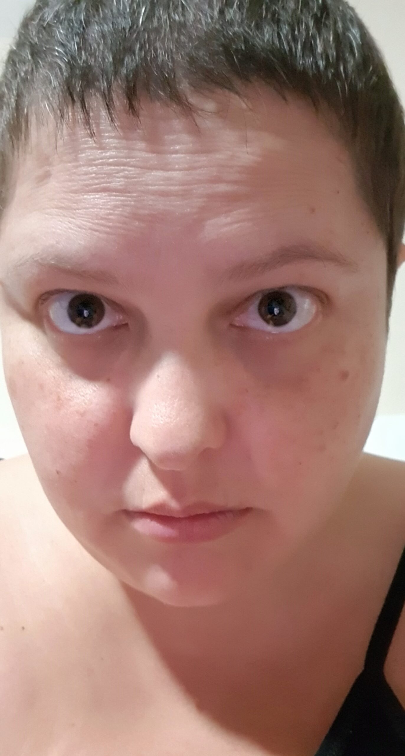 Nunca desista. Não deixe a doença ser maior que você!