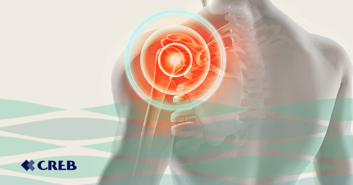 Artrose pode acometer o ombro, com possível perda do movimento