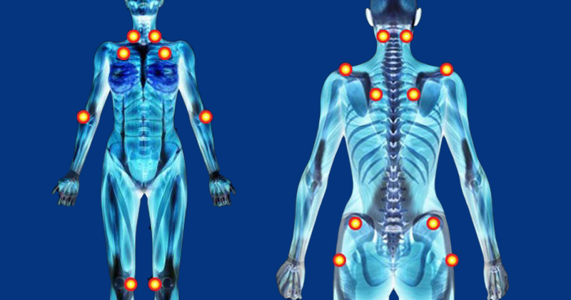 Fibromialgia e exercício físico