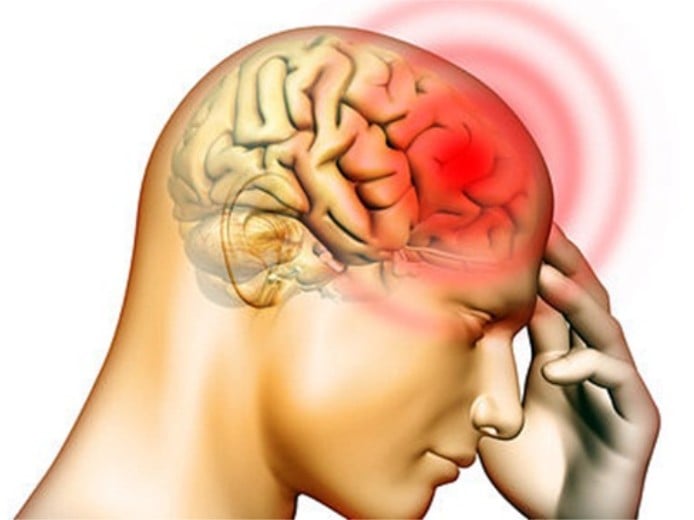 Enxaquecas: São comuns e existem 6 tipos diferentes