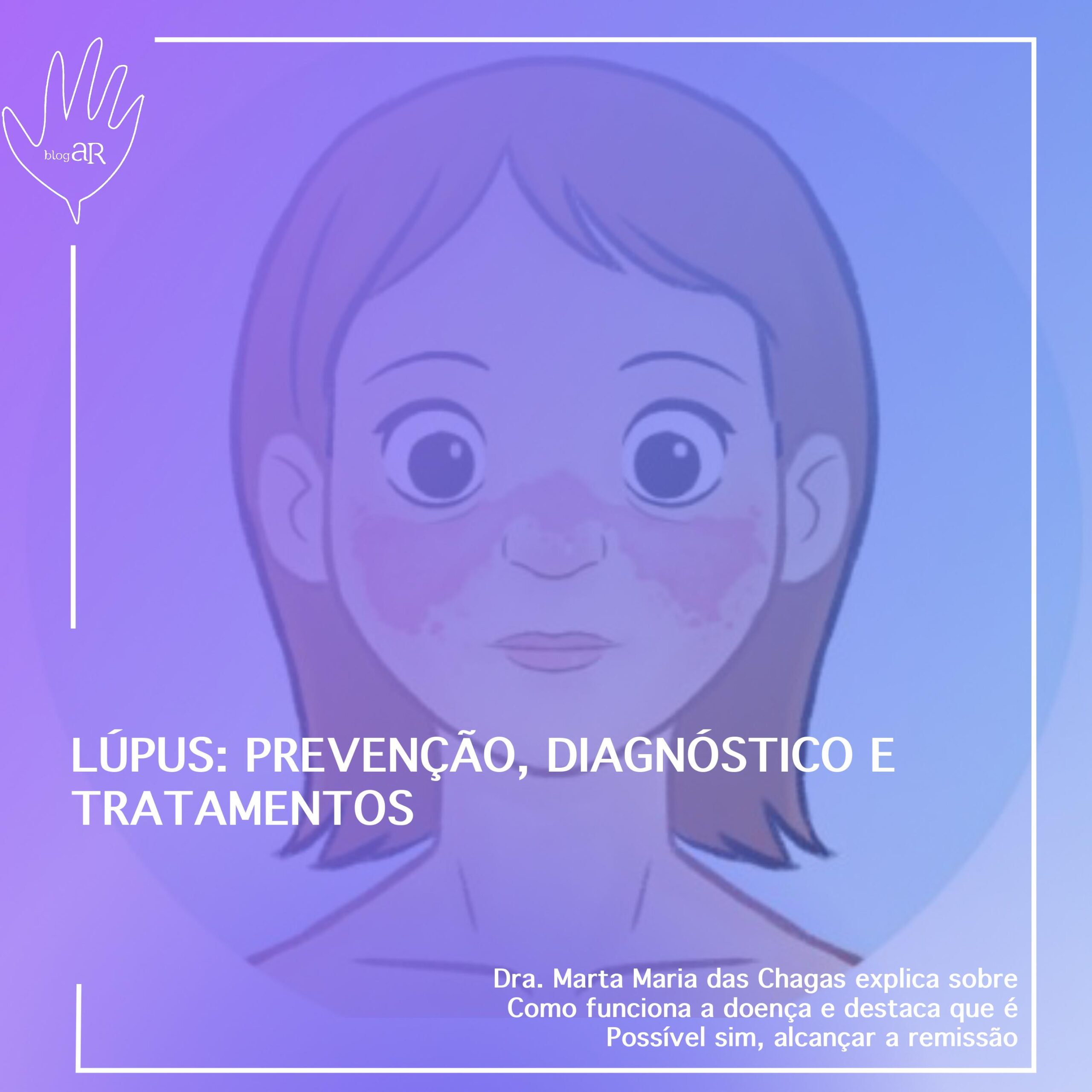 Lúpus: prevenção, diagnóstico e tratamentos