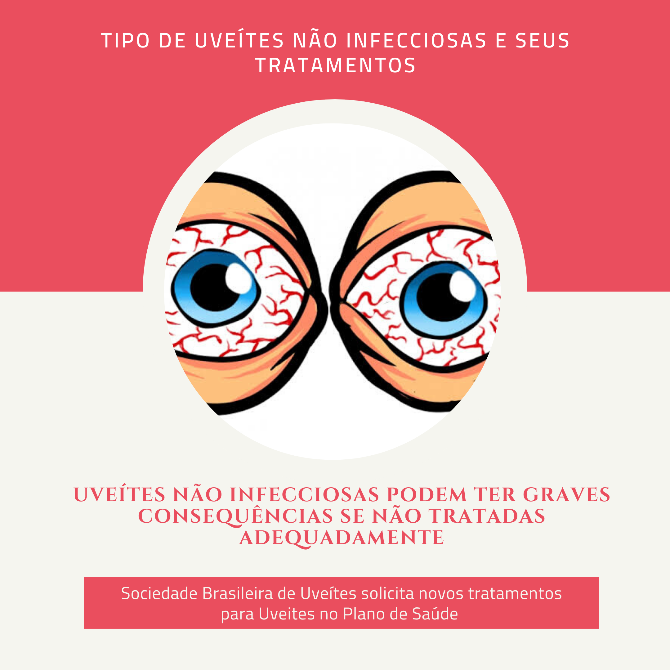 Uveítes não Infecciosas podem ter graves consequências se não tratadas adequadamente