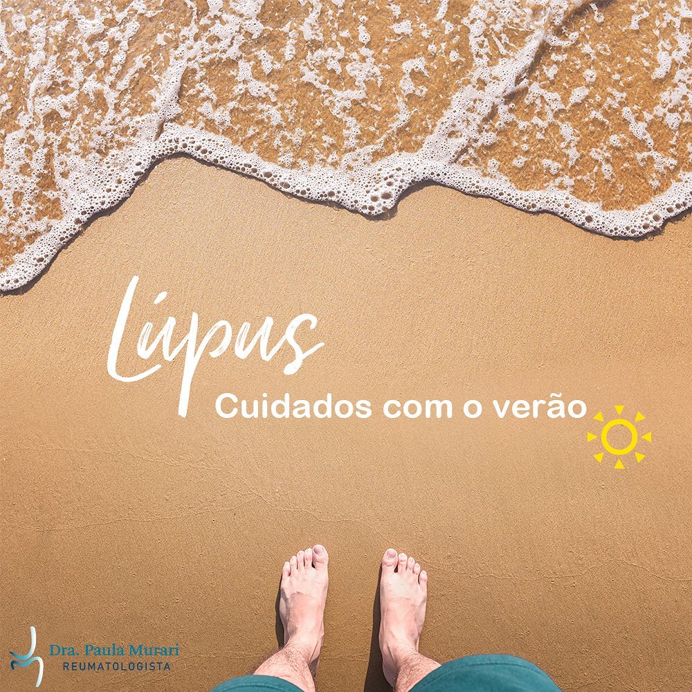 Lúpus – Cuidados com o verão