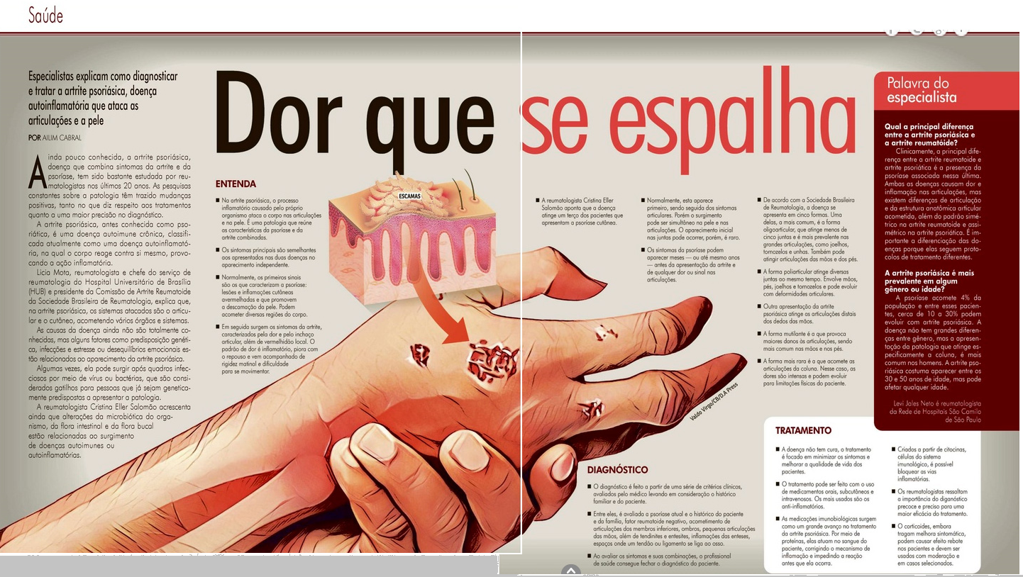 Artrite psoriásica na Revista do Correio (Correio Braziliense)