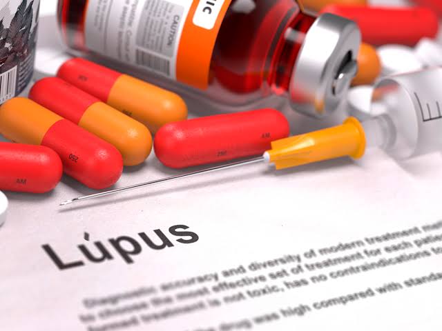 Ensaio clínico dá novas esperanças para um tratamento contra o lúpus