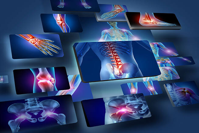 Osteoartrite, Osteoporose e Sarcopenia