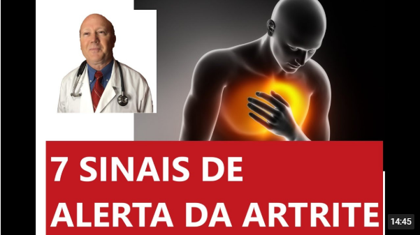 Os 7 sinais de alerta para complicações graves da artrite reumatoide.
