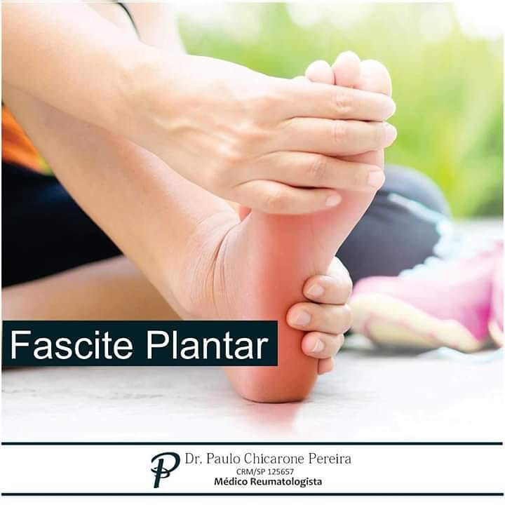 Fascite Plantar