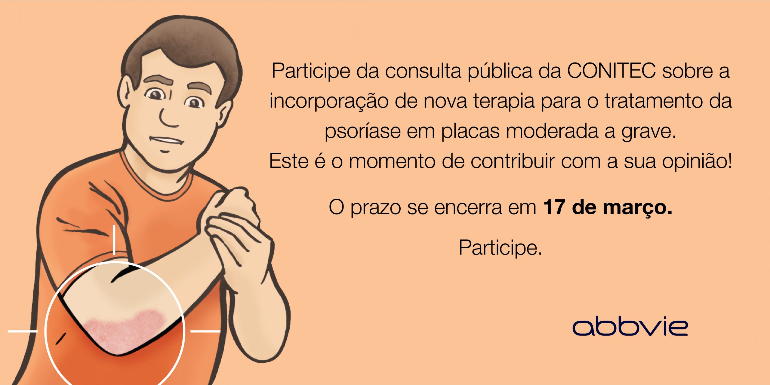 Atenção Pacientes com Psoríase, termina hoje (17/03) o prazo para solicitar ao SUS o fornecimento de um novo medicamento o Risanquizumabe