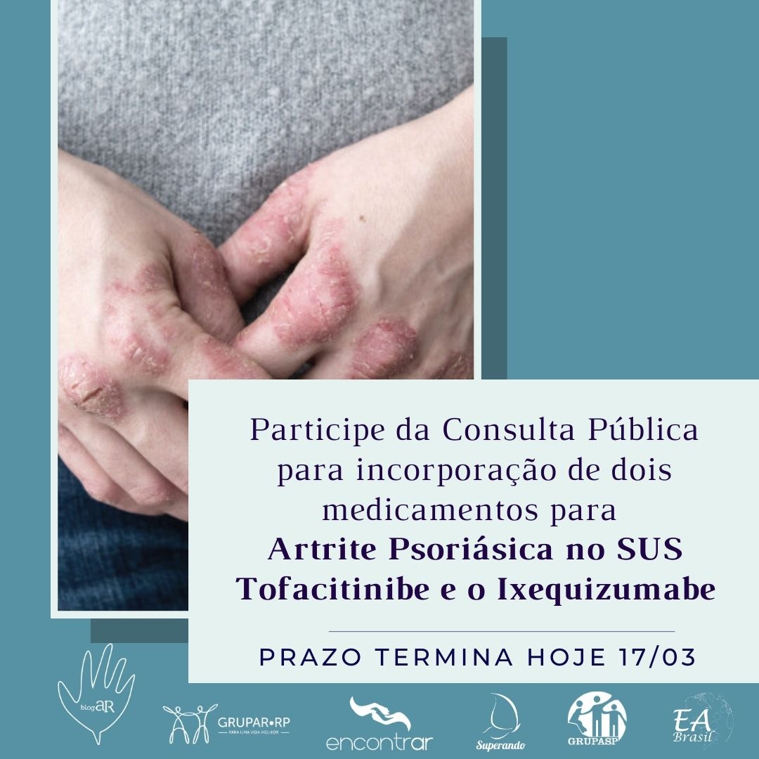 Tratamento para artrite psoriásica é tema de duas consultas públicas