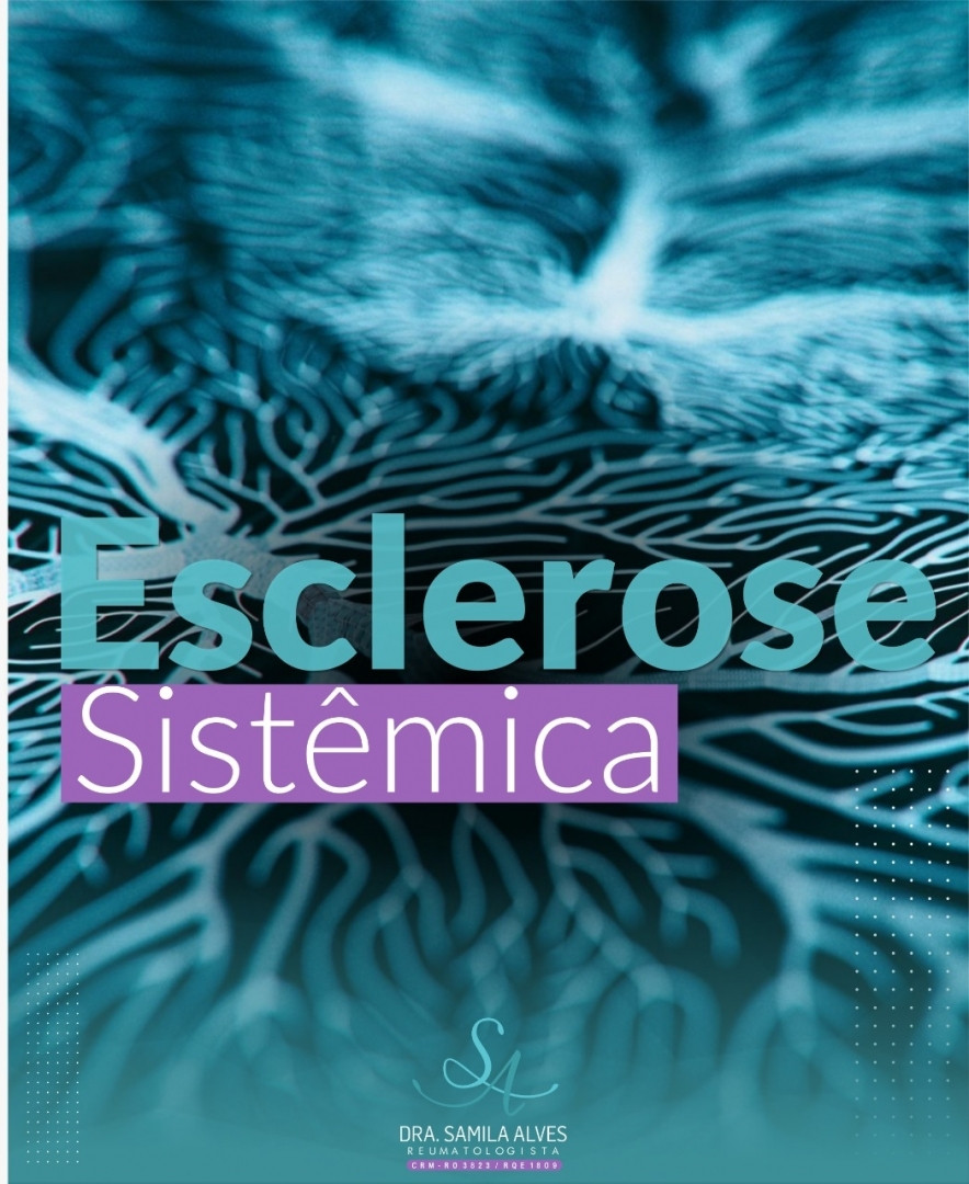 Esclerose Sistêmica