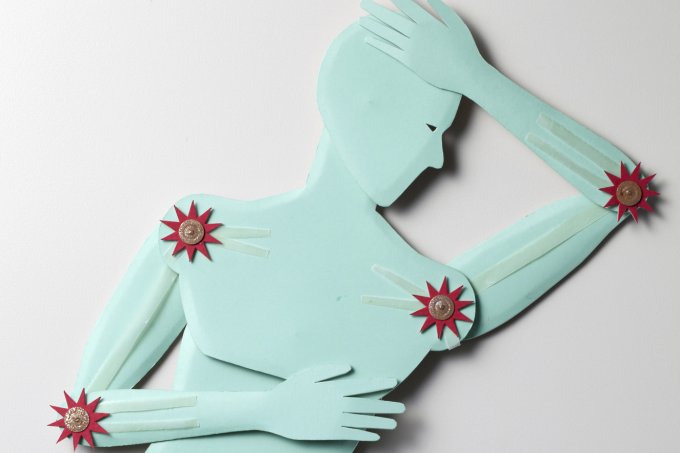 Coronavírus: quais cuidados pacientes com doenças reumatológicas devem ter