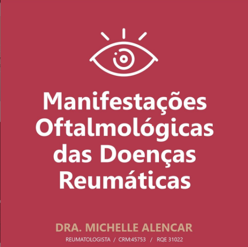 Manifestações Oftalmológicas das Doenças Reumáticas