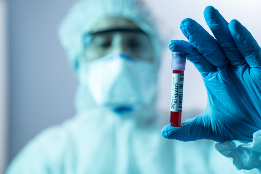 Cremesp denuncia Instituto Adolfo Lutz por invalidar amostras para testes de covid-19