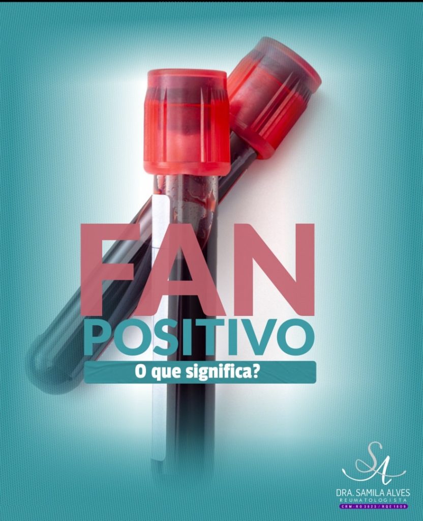 FAN Positivo – O que significa? - Artrite Reumatóide