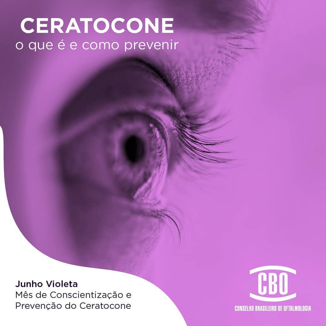 Ceratocone – O que é e como prevenir?