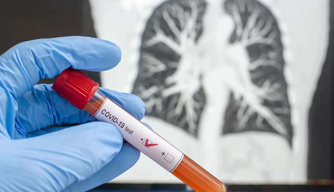 Cobertura no Plano de Saúde para os testes de Coronavírus será tema de reunião da Agência Nacional de Saúde Suplementar