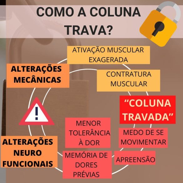 Guia de sobrevivência: “minha coluna travou - Artrite Reumatóide