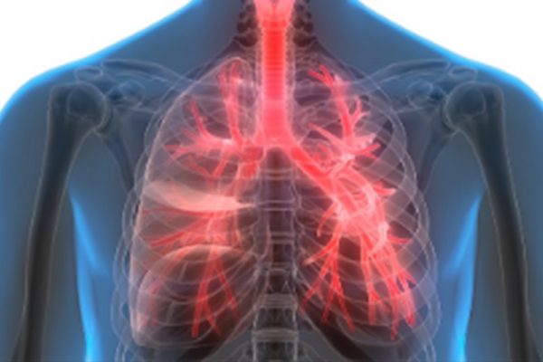 Anvisa aprova novo tratamento para doença pulmonar