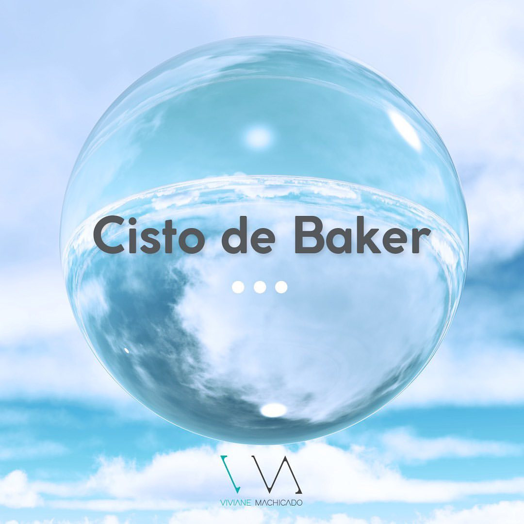 Cisto de Baker