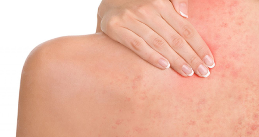 Exercícios de Alongamentos para Pacientes com Artrites