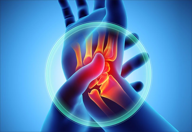 Webinário sobre Artrite Reumatoide e Artrite Psoriásica
