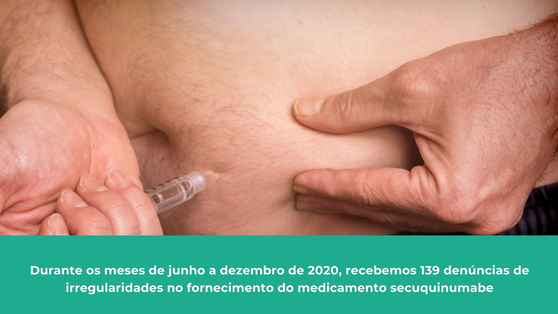 Informações do Ministério da Saúde sobre a disponibilidade do secuquinumabe nas farmácias de alto custo