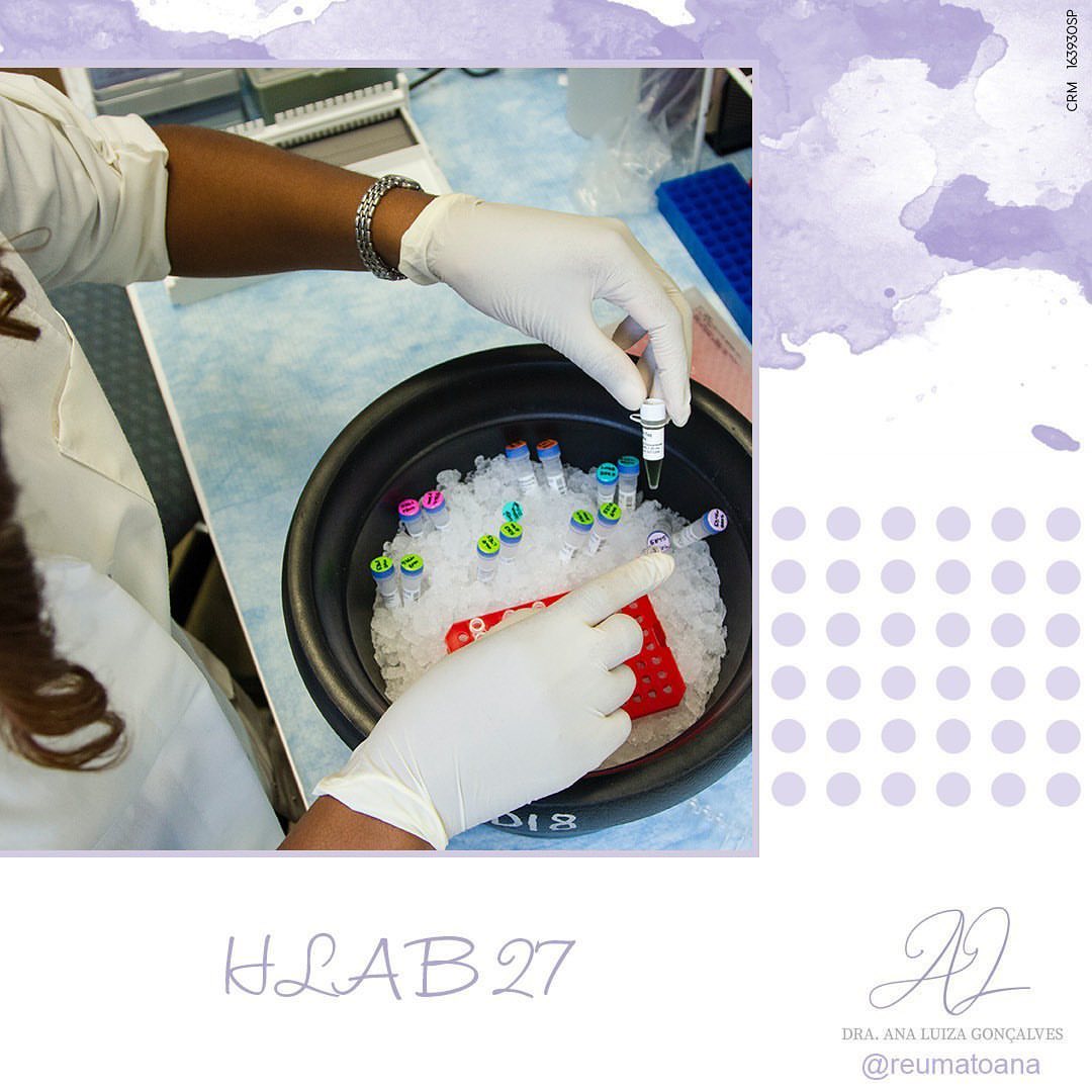 Exames diagnósticos HLA B 27