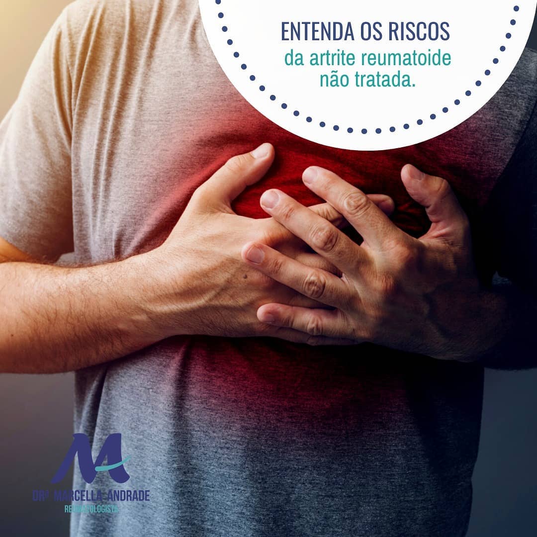 Entenda os riscos da artrite reumatoide não tratada