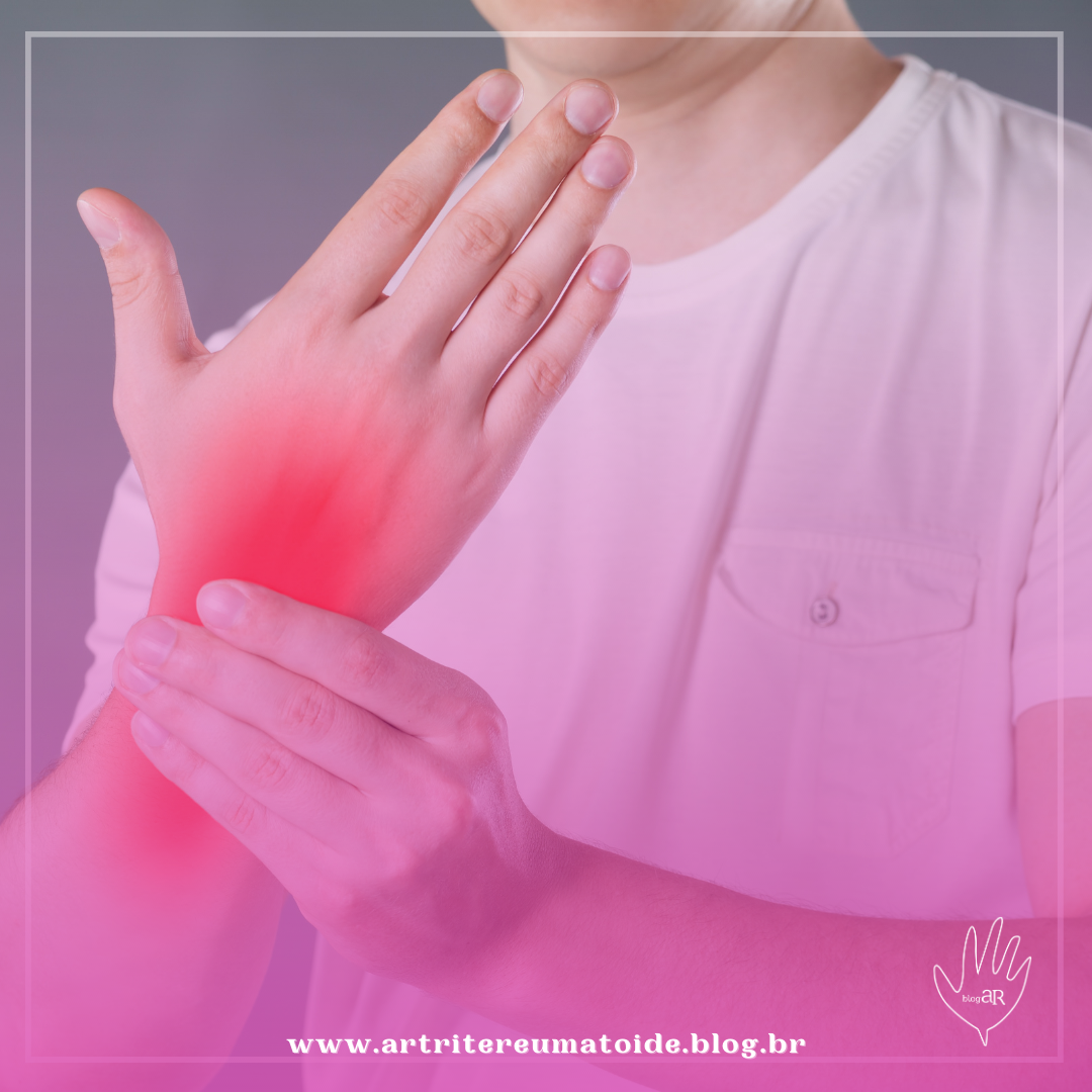 Dormência ou choque nas mãos? Pode ser síndrome do túnel do carpo