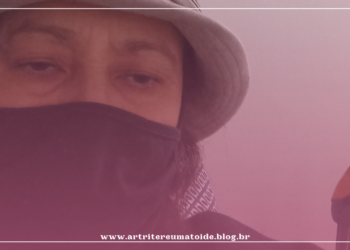 A jornada do paciente com Artrite Psoriásica é muito dolorida!