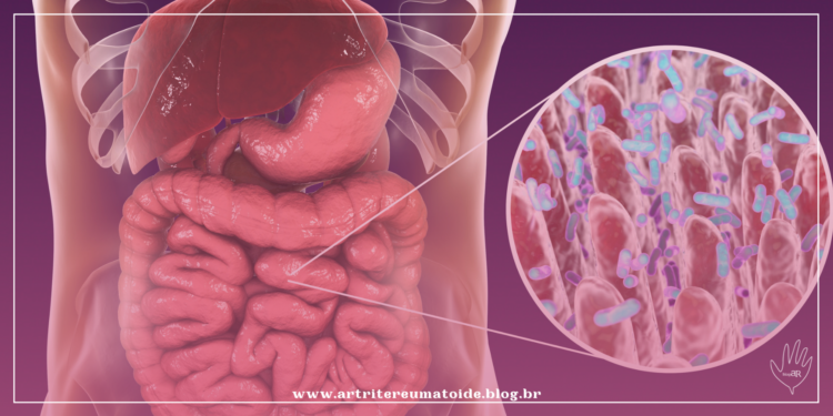 Maio Roxo alerta sobre sintomas, diagnósticos e tratamentos das doenças inflamatórias intestinais