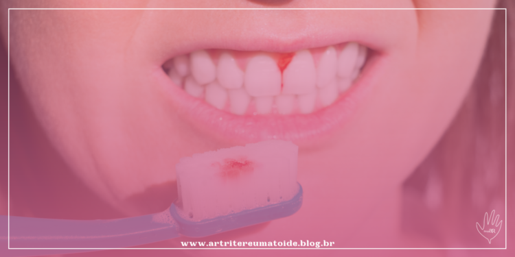 Periodontite, a inflamação que estraga o sorriso