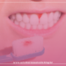 Periodontite, a inflamação que estraga o sorriso