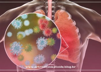 Pacientes reumáticos devem tomar a vacina contra pneumonia disponível no SUS