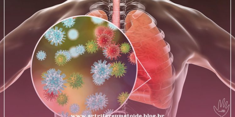 Pacientes reumáticos devem tomar a vacina contra pneumonia disponível no SUS
